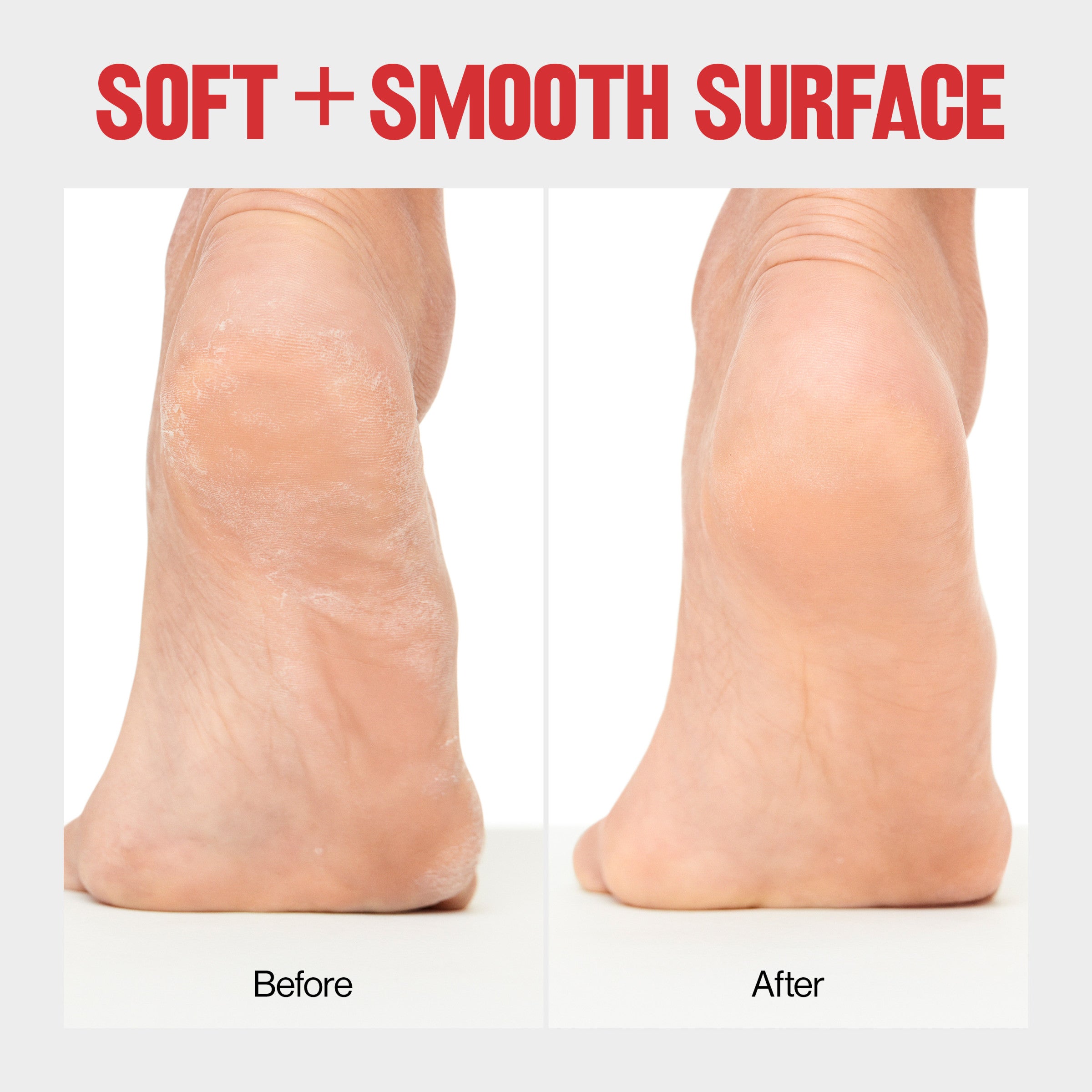 Wet/Dry Foot File - Pedicure Tool - Image 4